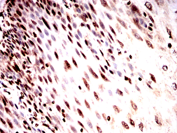 SPHK2 Antibody