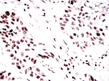 SPHK2 Antibody