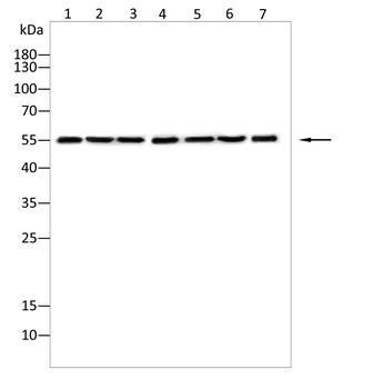 SPHK2 Antibody