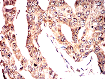 SPHK2 Antibody