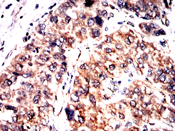 SPHK2 Antibody