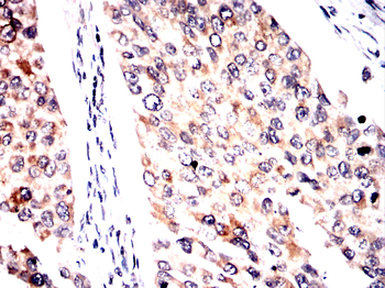 SPHK2 Antibody
