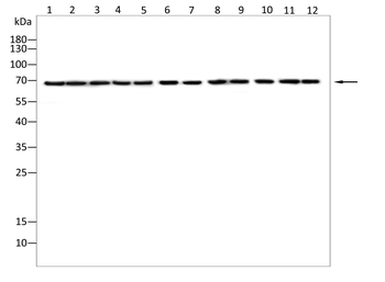 SPHK2 Antibody