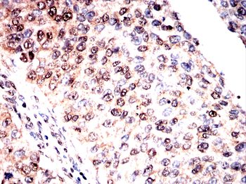 SNRPA1 Antibody