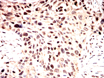 SNRPA1 Antibody
