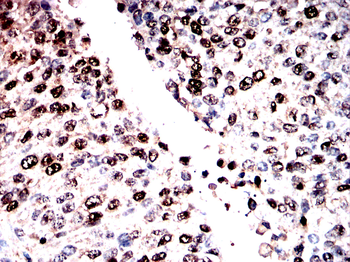 SNRPA1 Antibody