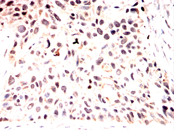 SNRPA1 Antibody