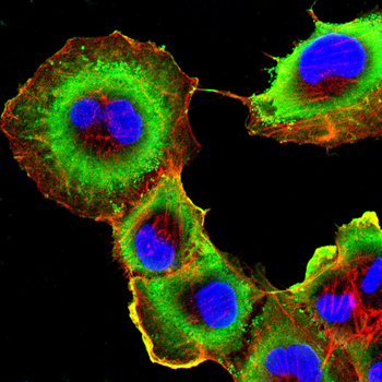 SLC16A3 Rabbit Polyclonal Antibody