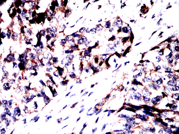 SLC16A3 Rabbit Polyclonal Antibody