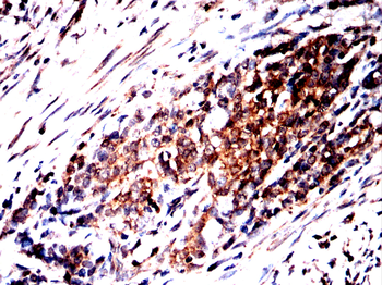 SLC16A3 Rabbit Polyclonal Antibody