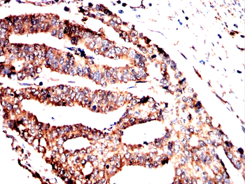 SLC16A3 Rabbit Polyclonal Antibody