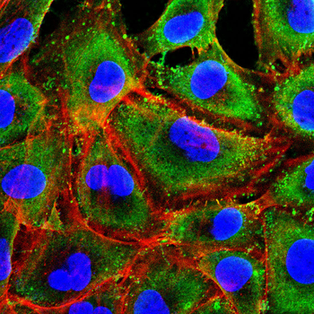 PVALB Antibody