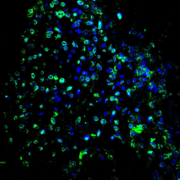 PVALB Antibody