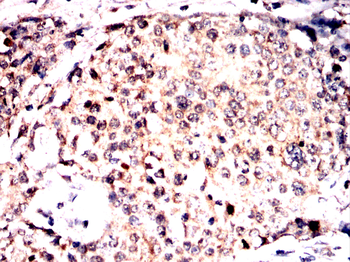 PVALB Antibody