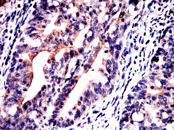 PVALB Antibody