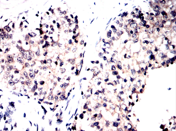 Flag tag antibody