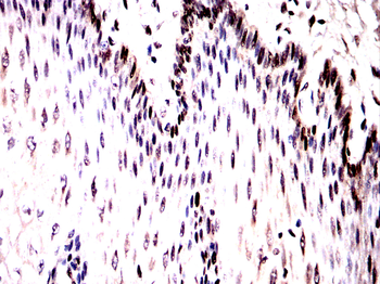 Myc tag antibody