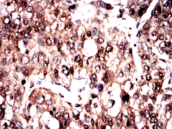 Myc tag antibody