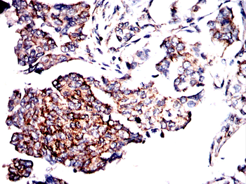 TUBB Antibody