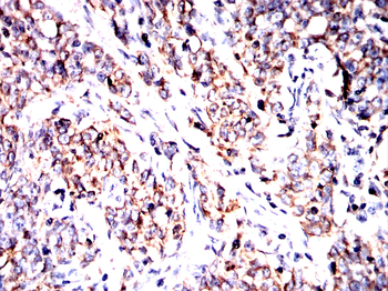 TUBB Antibody
