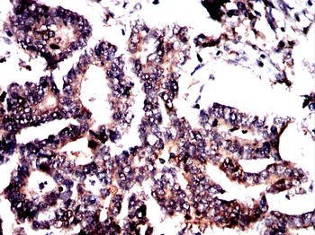 BCL2 Antibody