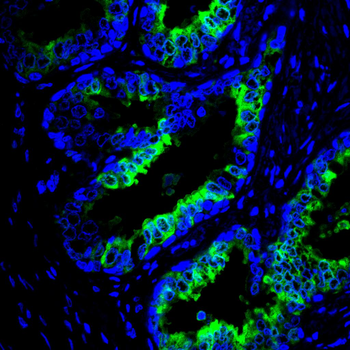 BCL2 Antibody