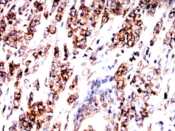 BCL2 Antibody