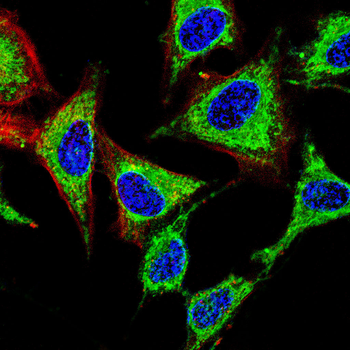 AKT1 Antibody