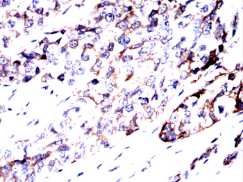 AKT1 Antibody