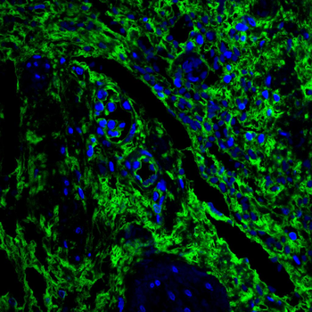 AKT1 Antibody