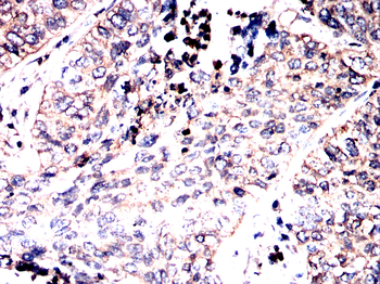 AKT1 Antibody