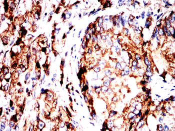 AKT1 Antibody