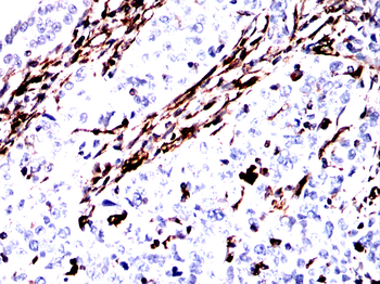 VIM Antibody
