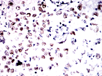 TP53 Antibody