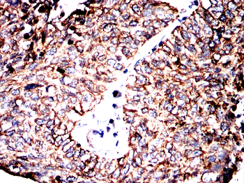 KRT8 Antibody