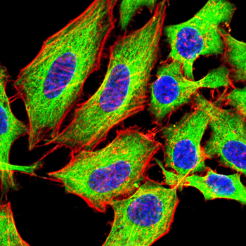 KRT18 Antibody
