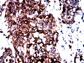 KRT18 Antibody
