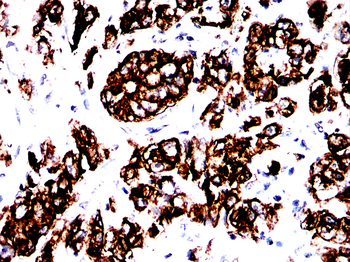 KRT18 Antibody