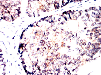 PRKAA1 Antibody