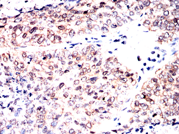 GSK3B Antibody
