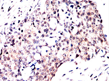 GSK3B Antibody