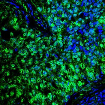 GSK3B Antibody