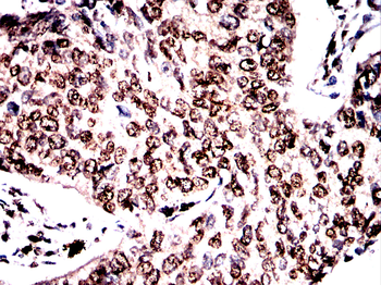 GSK3B Antibody