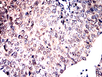 STAT3 Antibody