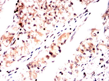 LRP1 Antibody
