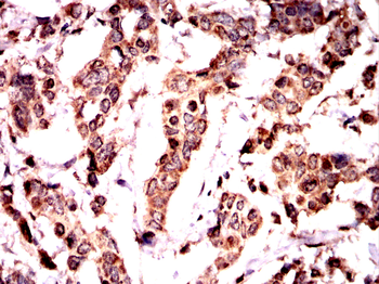 HMGA2 Antibody