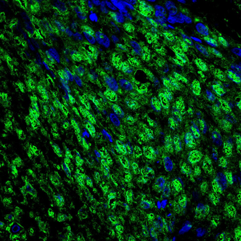 HMGA2 Antibody