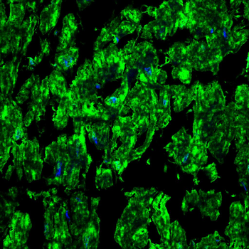 GLS Antibody