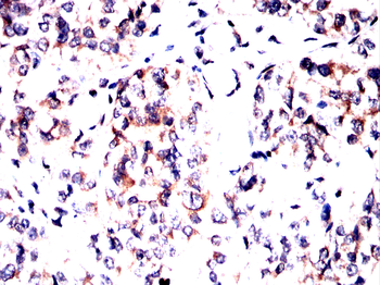 GLS Antibody