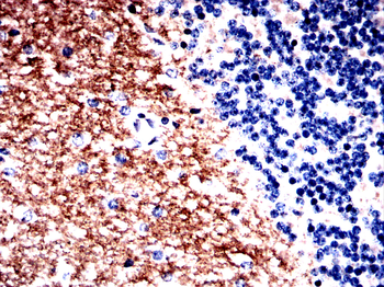 GLS Antibody